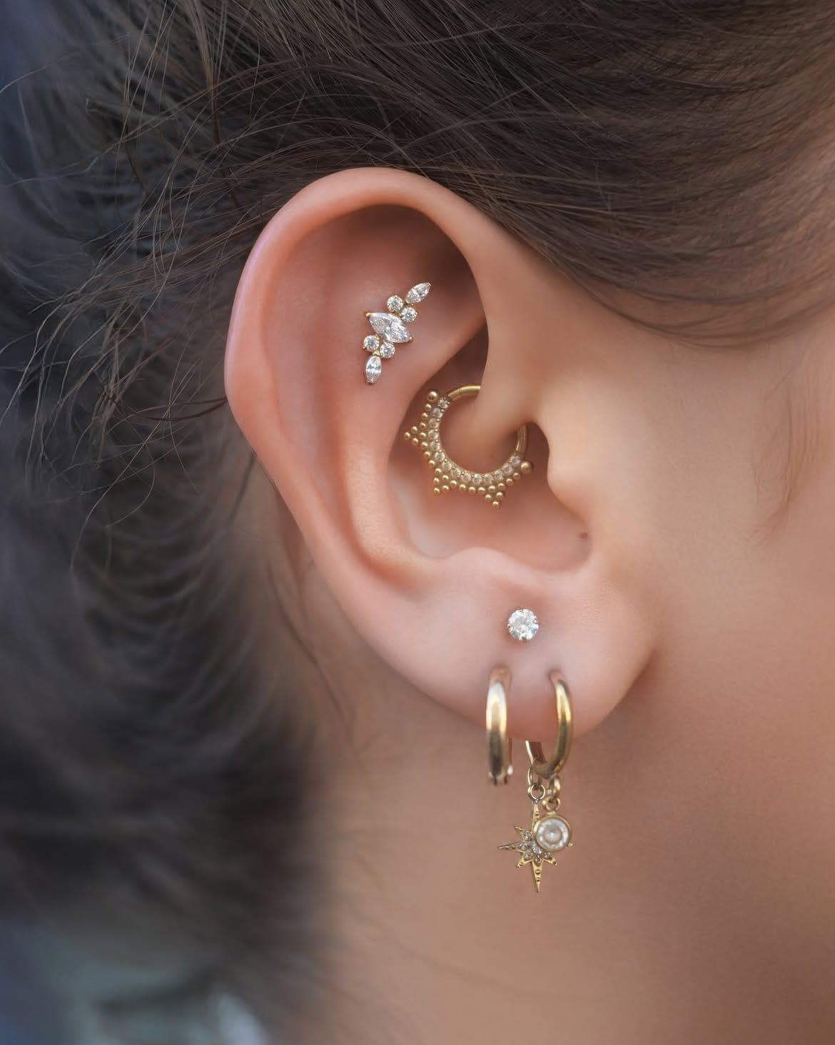 Daith - Flat - Upper lobe