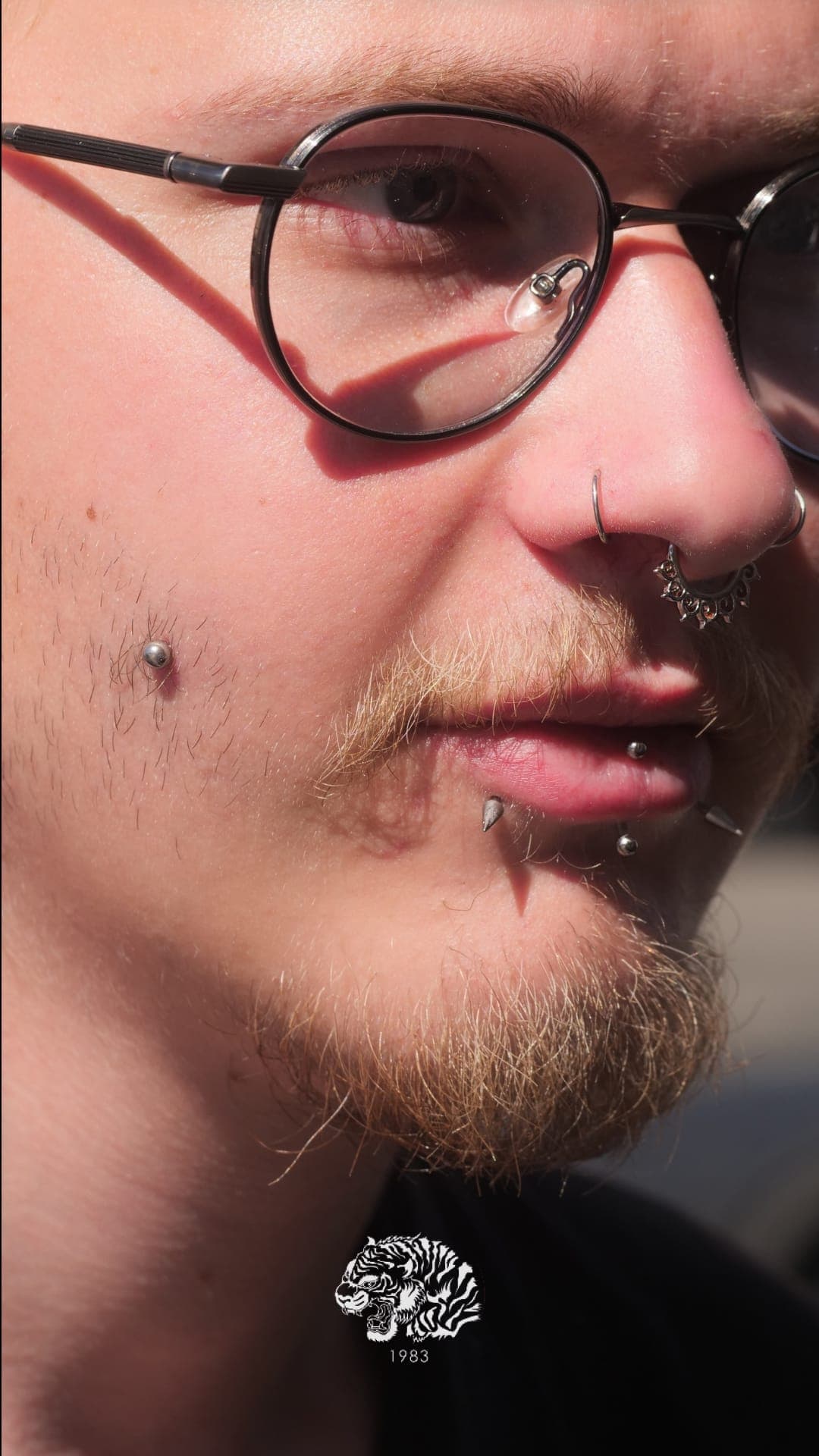 Cheeks - Snake bites