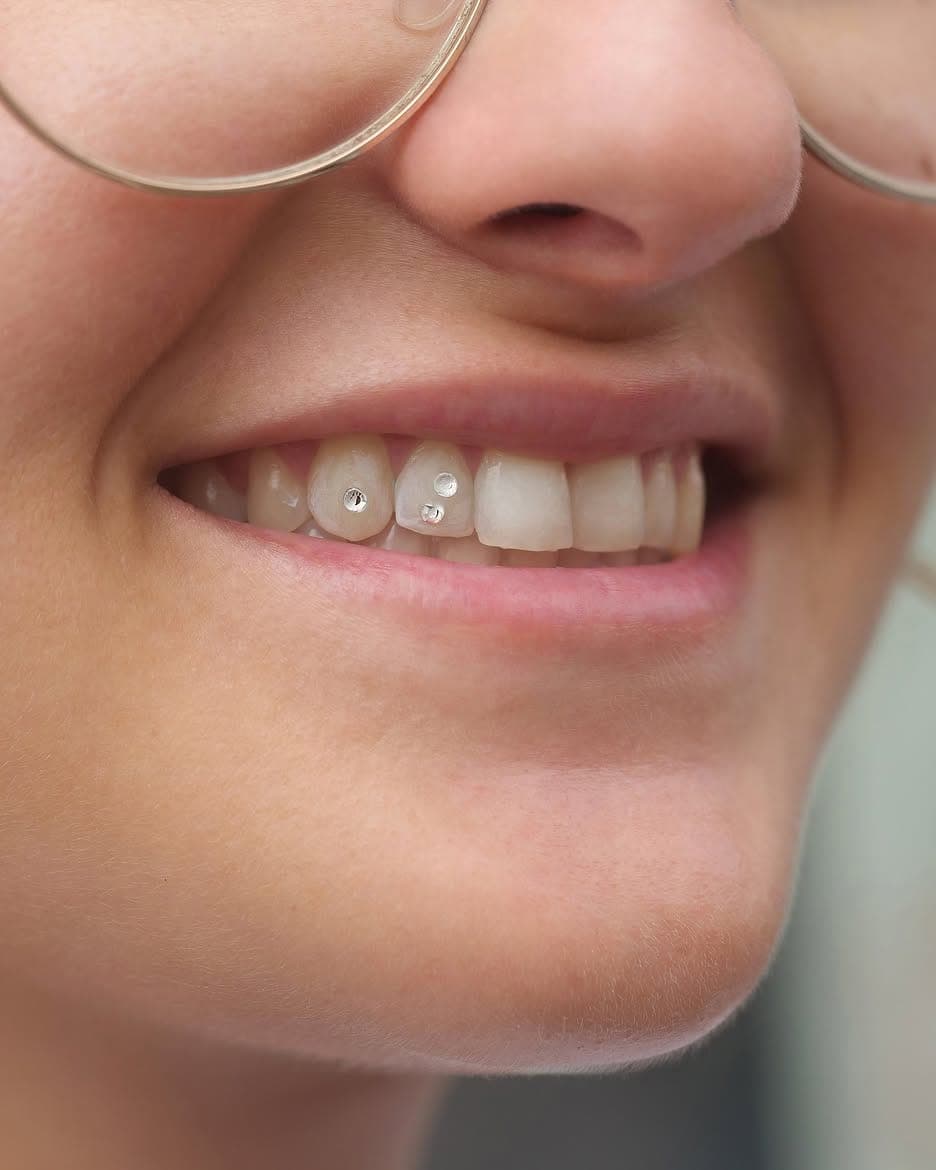 Strass dentaire