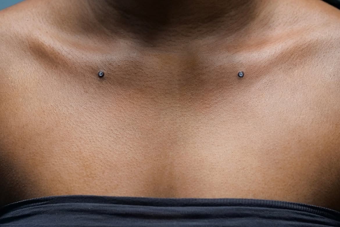 Dermal poitrine